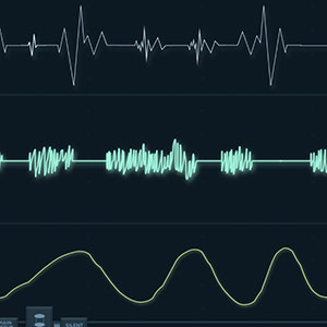 Ambulatory Heart Monitors