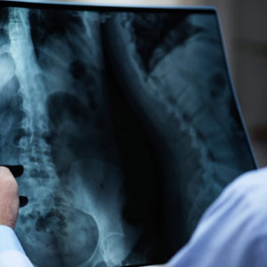 Digital X-Ray (DR Imaging System)