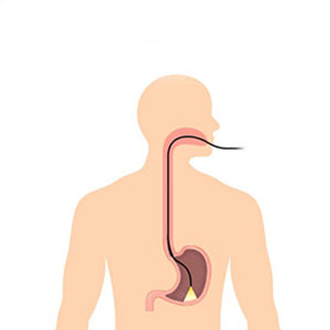 Esophagogastroduodenoscopy