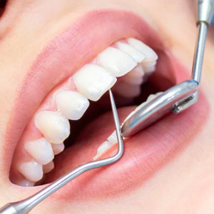Full Mouth Reconstruction