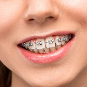 Ortho Dentistry