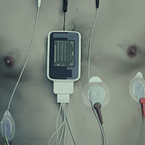 holter monitor